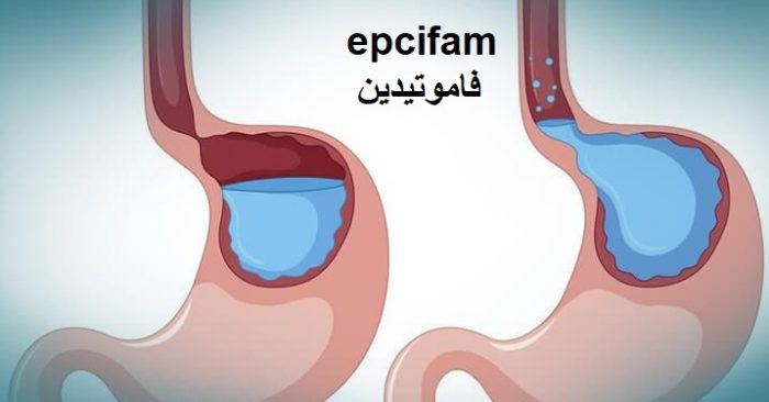 epcifam فاموتيدين 10 مجم لـ نوبات الحموضة والحرقة وتخفيف أعراض الارتجاع