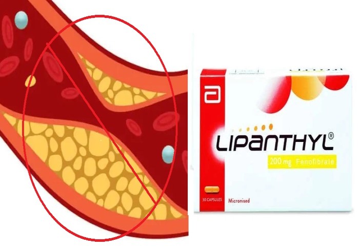 lipanthyl