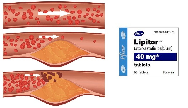lipitor