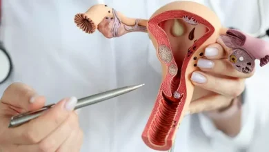 Photo of ما هي طرق علاج تكيس المبايض للمتزوجة؟
