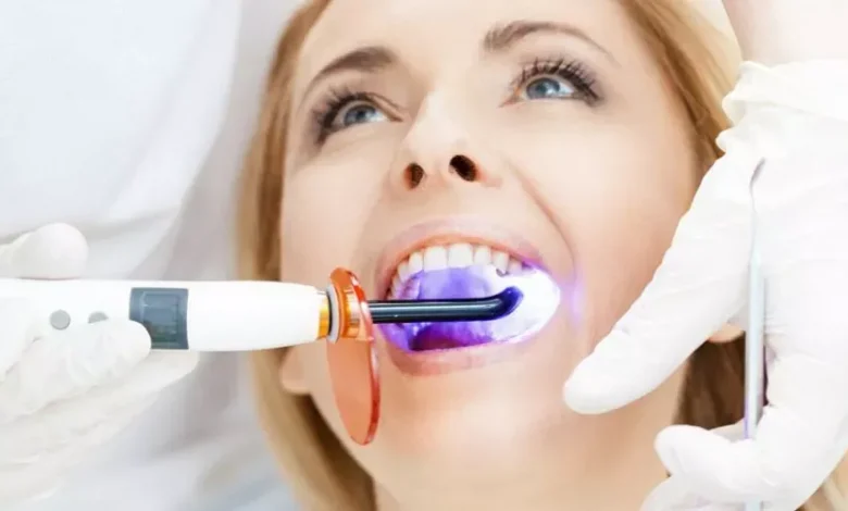 علاج لتبيض الاسنان