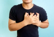 النوبة القلبية الكاذبة