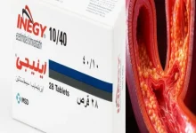 انيجي