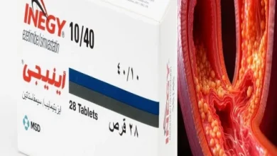 انيجي