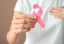 سرطان الثدي الالتهابي
